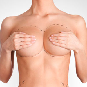 mamoplastia clinica renacer